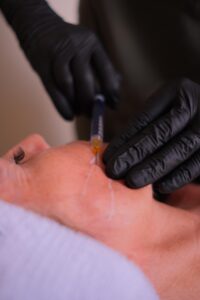 Client receiving a Profhilo treatment at Ashlyns Medispa in Essex to improve skin hydration, firmness and overall skin quality.
